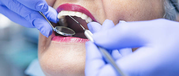 Best Emergency Treatment for Dental Infections or Abscesses in Morris, AL